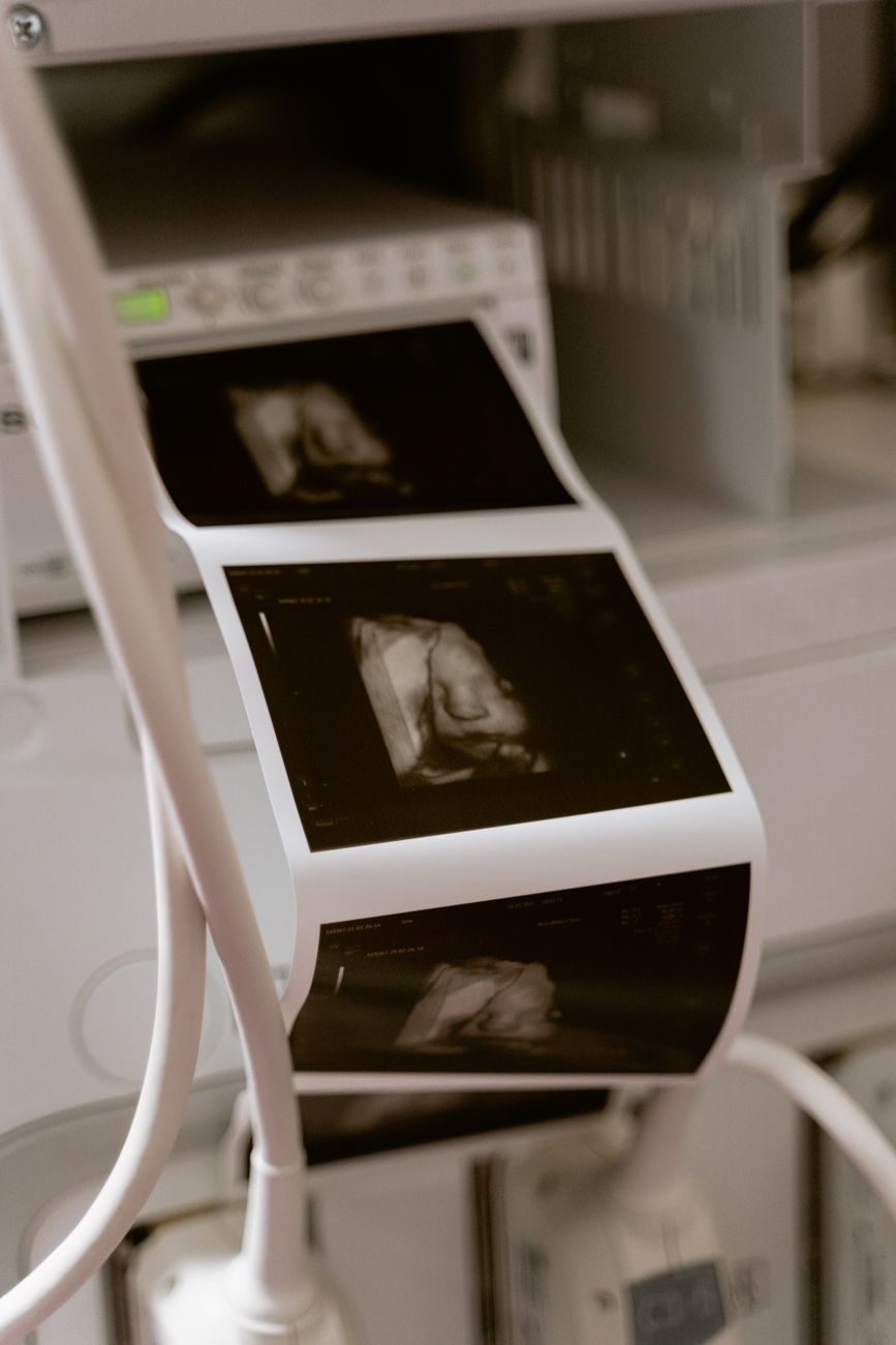 CADEM: 27% está de acuerdo con que un médico esté obligado a mostrar los latidos del feto o bebé antes de realizar un aborto
